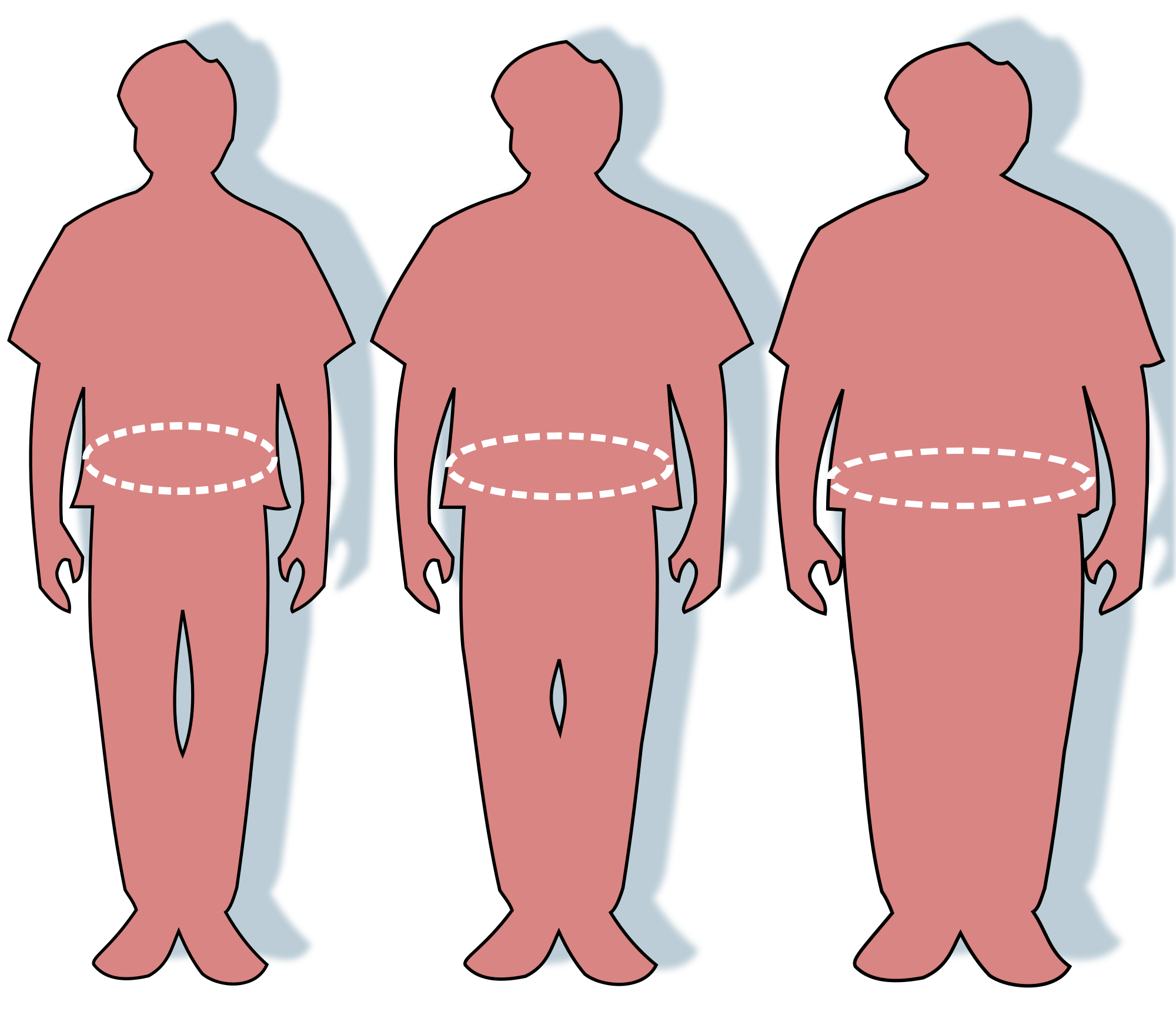 2000px-Obesity-waist_circumference.svg