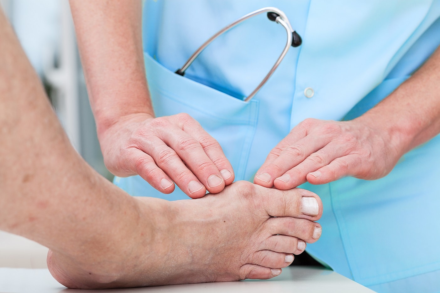 diabetic foot, wound care feet