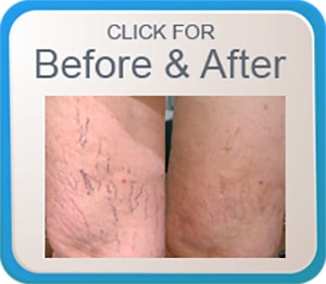 Before-and-After