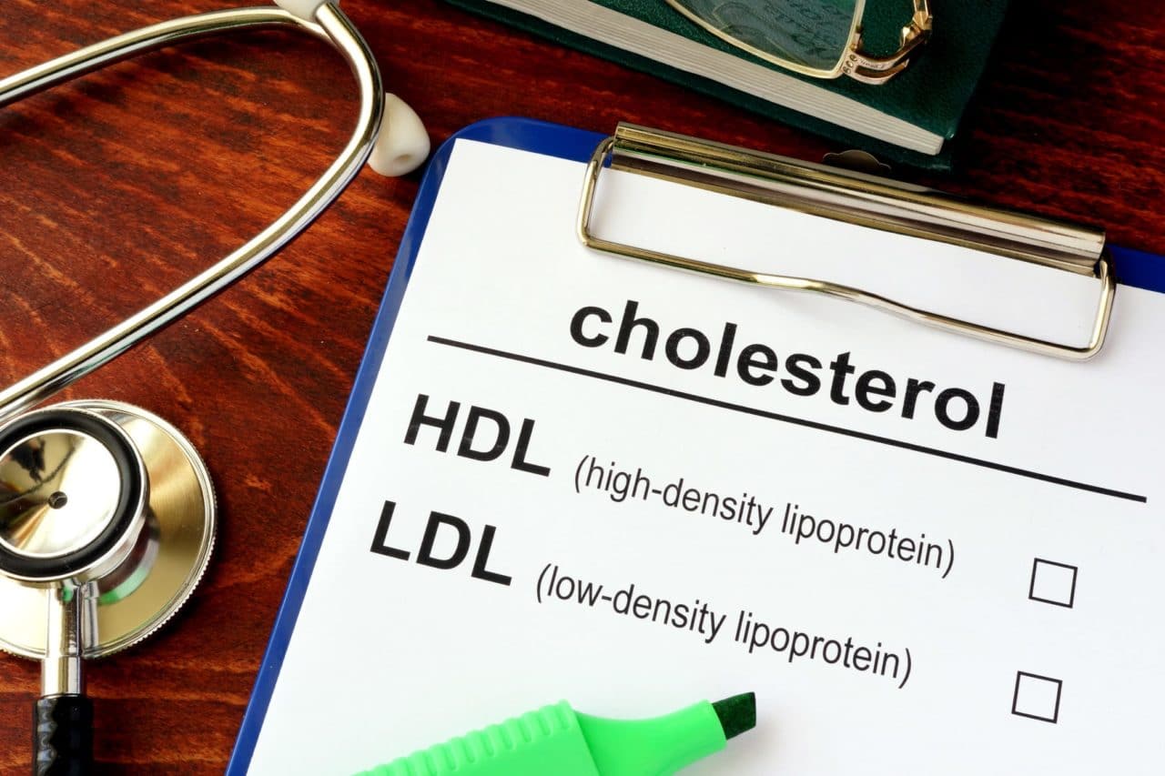 High Cholesterol/Hyperlipidemia and Its Role/Causes in Peripheral Arterial Disease (PAD)