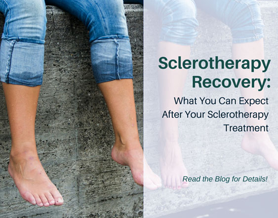 Instructions-after-Sclerotherapy