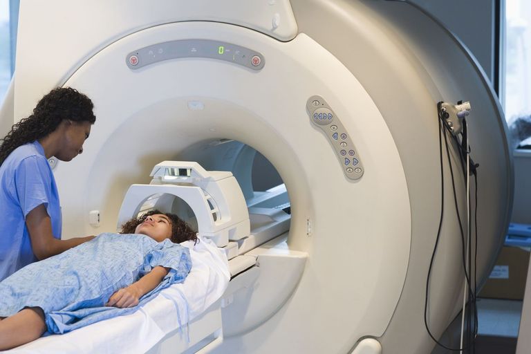 Pelvic Congestion - MRI