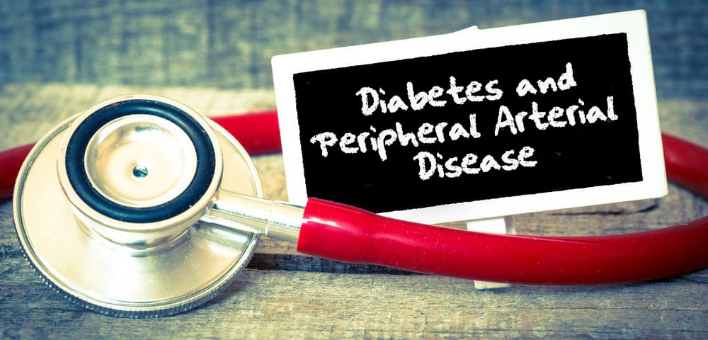 Peripheral Arterial Disease and Diabetes