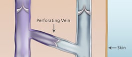 Perforator Veins