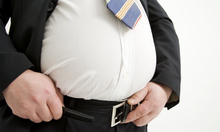 Peripheral Vascular Disease obesity