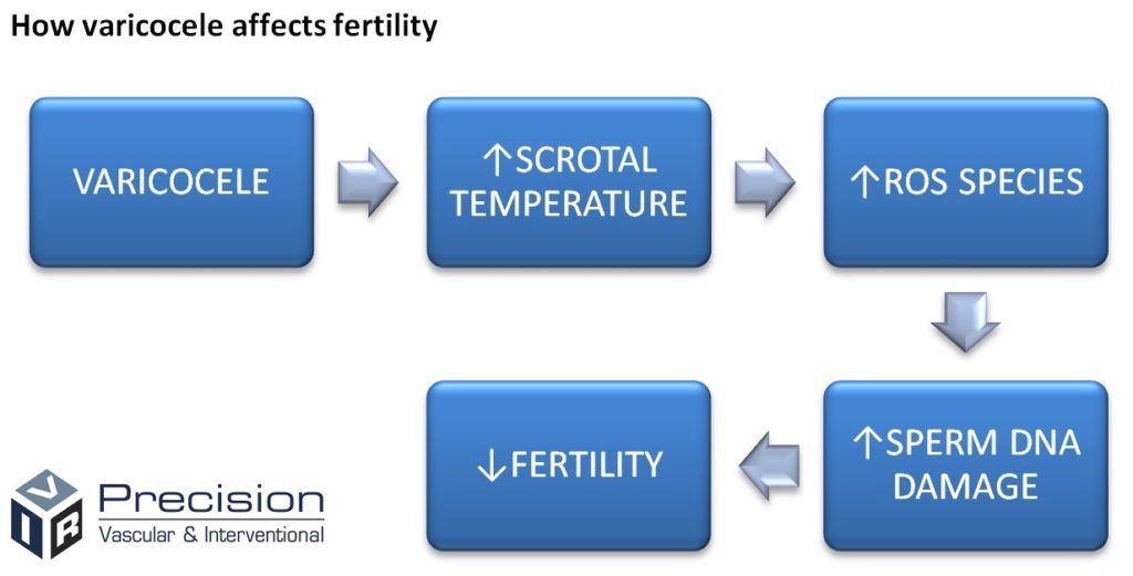 Varicocele Men Fertility