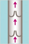 Healthy Veins no Varicose Veins