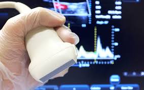 Ultrasound tests to check for blood clots within the legs or the arms.